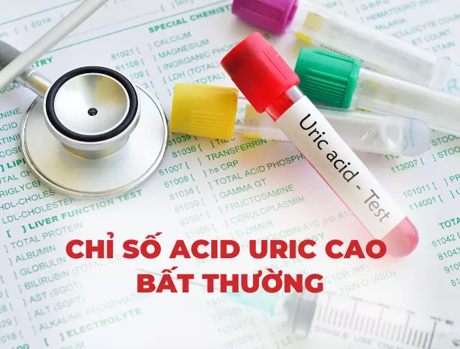 Chỉ số acid uric cao bất thường - Cần làm gì để cải thiện?